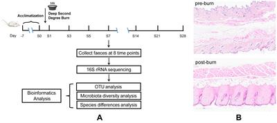 Microbial community succession in the intestine of mice with deep partial-thickness burns